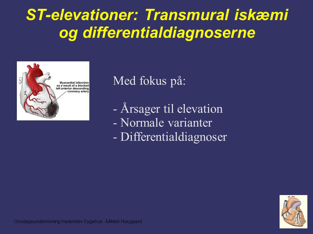 Onsdagsundervisning Haderslev Sygehus - Mikkel Hougaard ST-elevationer: Transmural iskæmi og differentialdiagnoserne Med fokus på: - Årsager til elevation - Normale varianter - Differentialdiagnoser