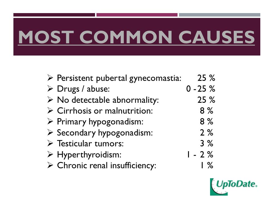 MOST COMMON CAUSES  Persistent pubertal gynecomastia:25 %  Drugs / abuse:0 -25 %  No detectable abnormality:25 %  Cirrhosis or malnutrition:8 %  Primary hypogonadism:8 %  Secondary hypogonadism:2 %  Testicular tumors:3 %  Hyperthyroidism:1 -2 %  Chronic renal insufficiency:1 %