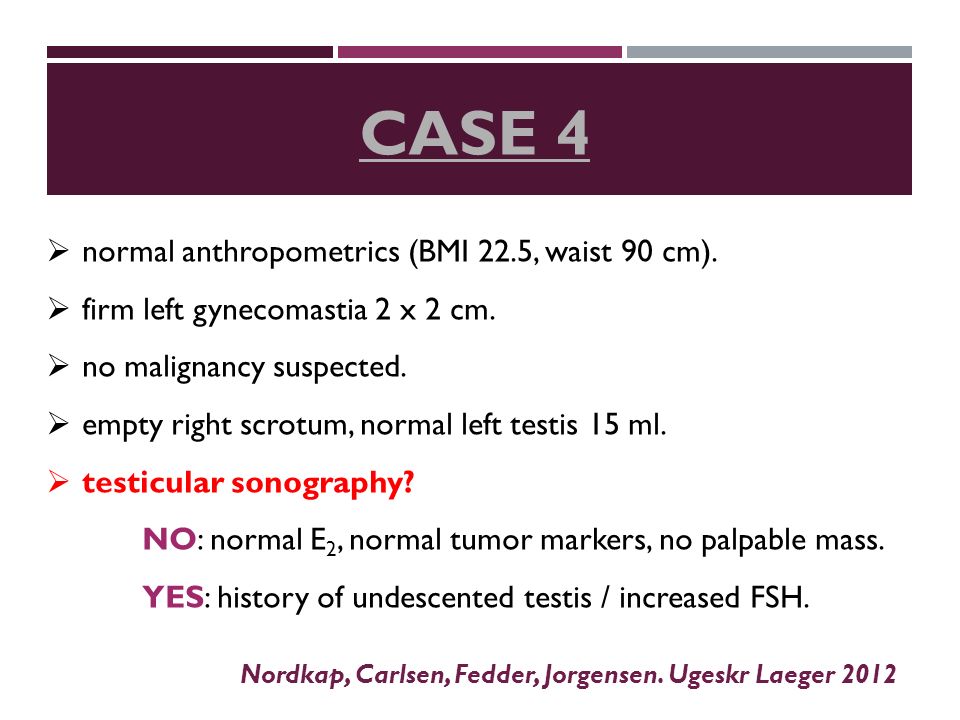  normal anthropometrics (BMI 22.5, waist 90 cm).  firm left gynecomastia 2 x 2 cm.