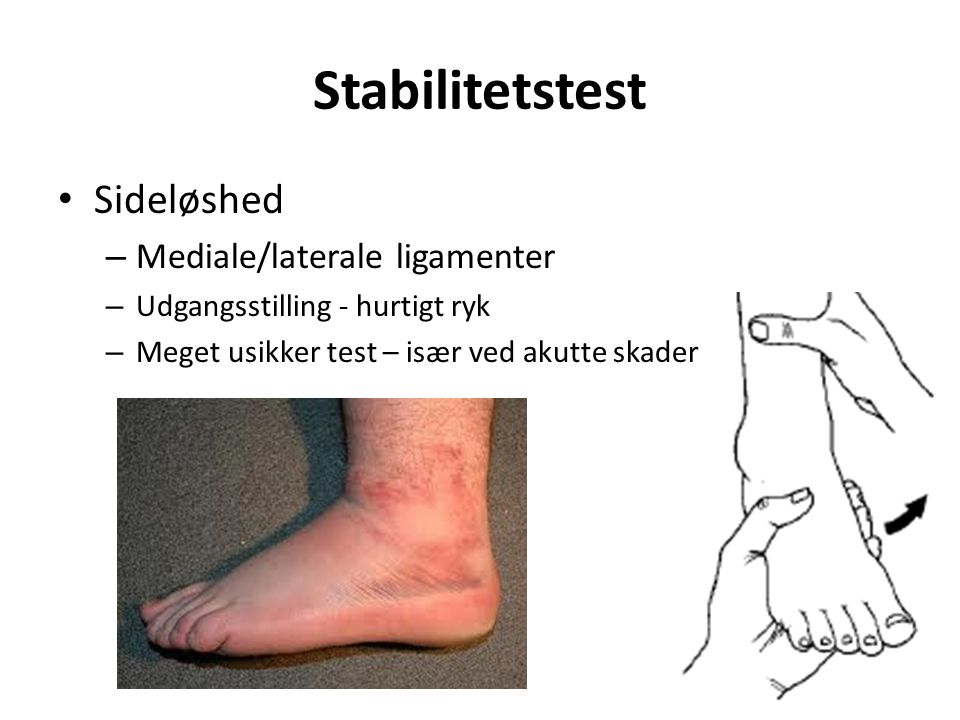 Stabilitetstest Sideløshed – Mediale/laterale ligamenter – Udgangsstilling - hurtigt ryk – Meget usikker test – især ved akutte skader