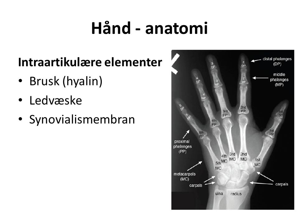 Hånd - anatomi Intraartikulære elementer Brusk (hyalin) Ledvæske Synovialismembran