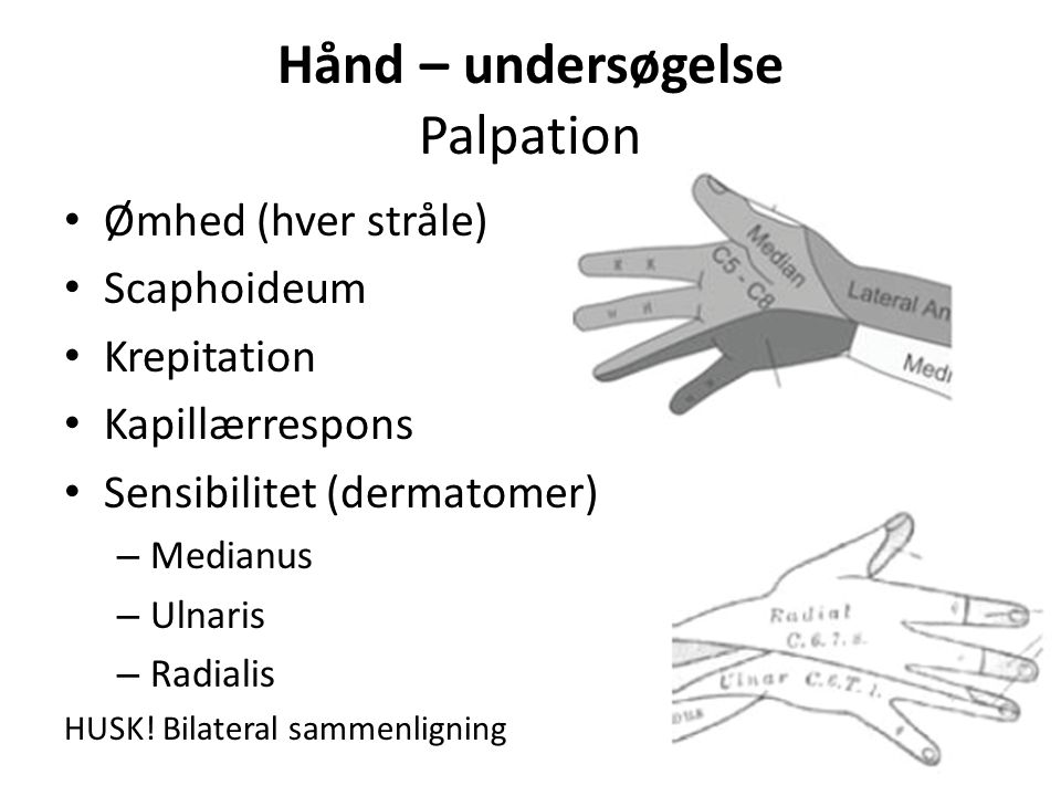 Hånd – undersøgelse Palpation Ømhed (hver stråle) Scaphoideum Krepitation Kapillærrespons Sensibilitet (dermatomer) – Medianus – Ulnaris – Radialis HUSK.