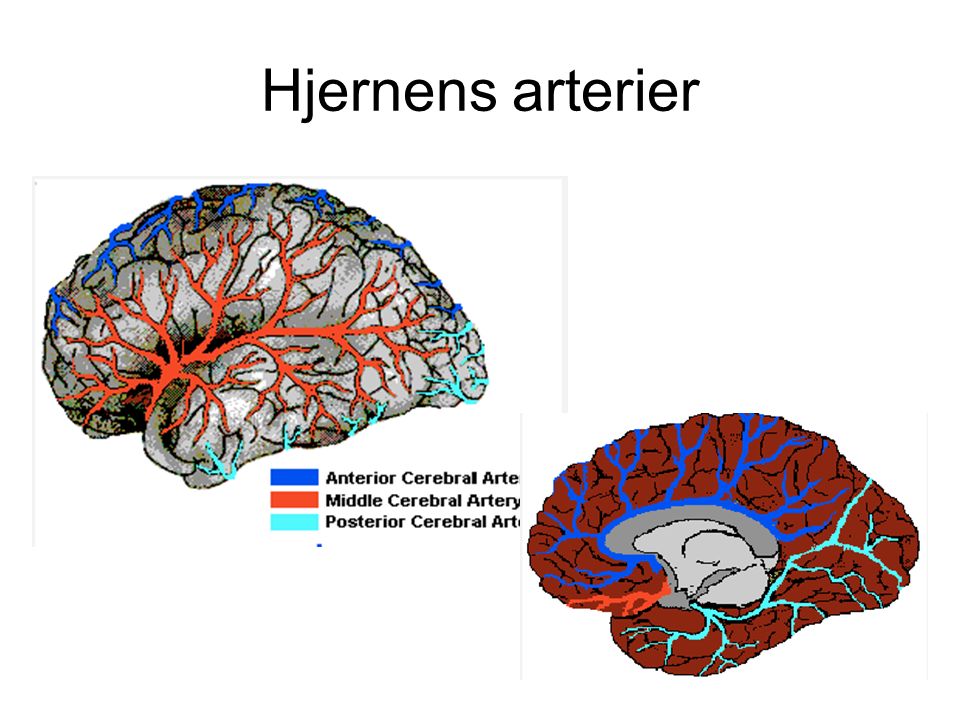 Hjernens arterier