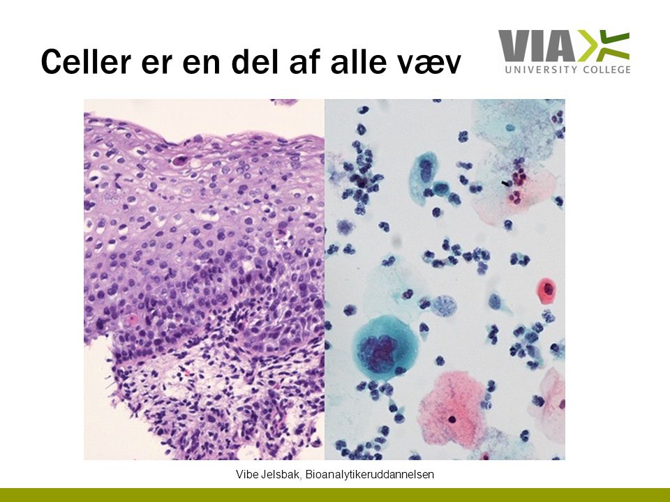 Celler er en del af alle væv Vibe Jelsbak, Bioanalytikeruddannelsen