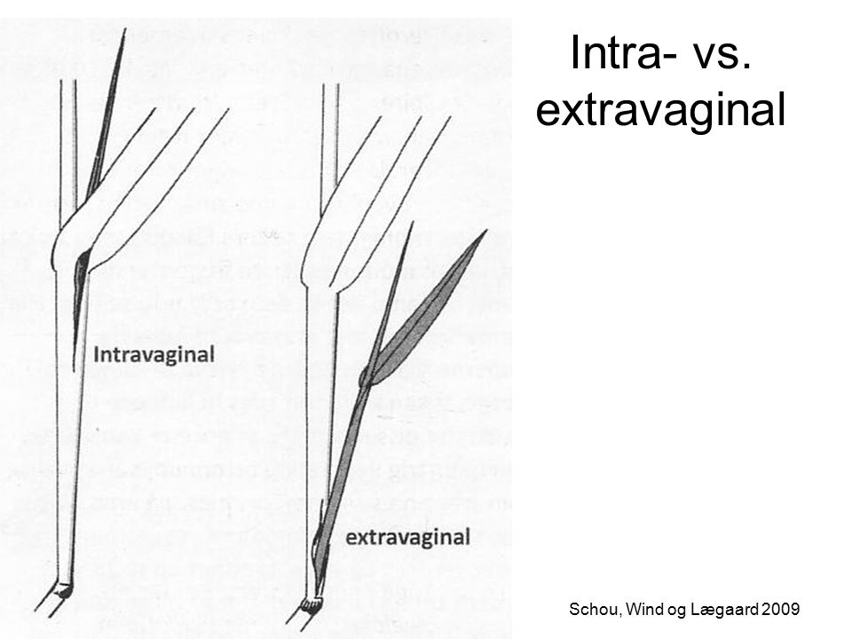 Intra- vs. extravaginal Schou, Wind og Lægaard 2009